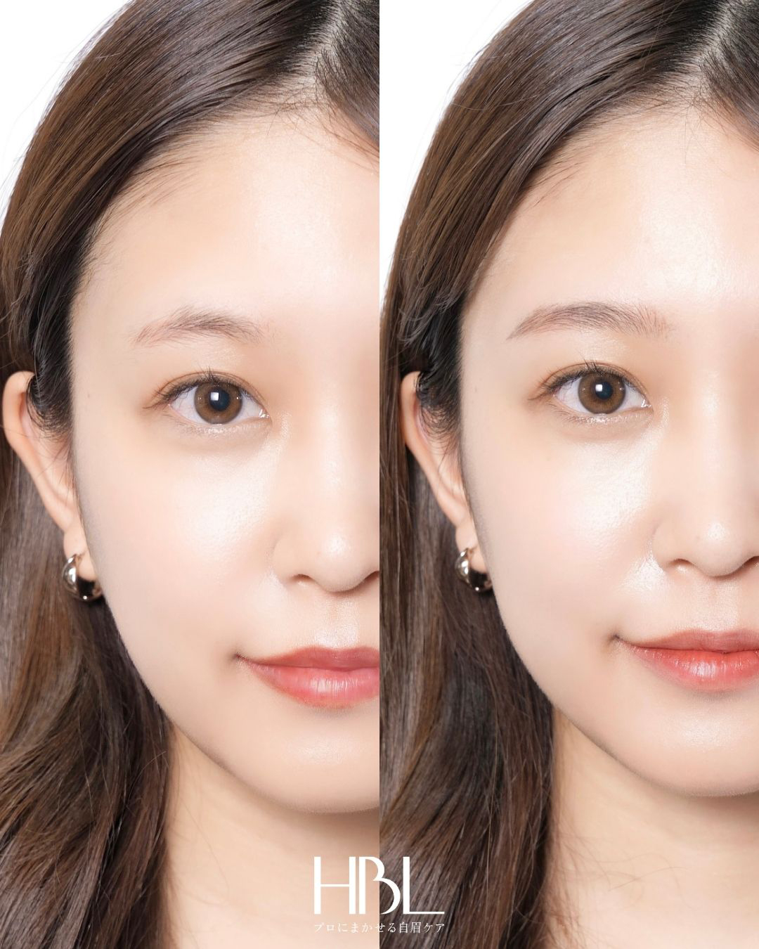 HOLLYWOOD BROW LIFT