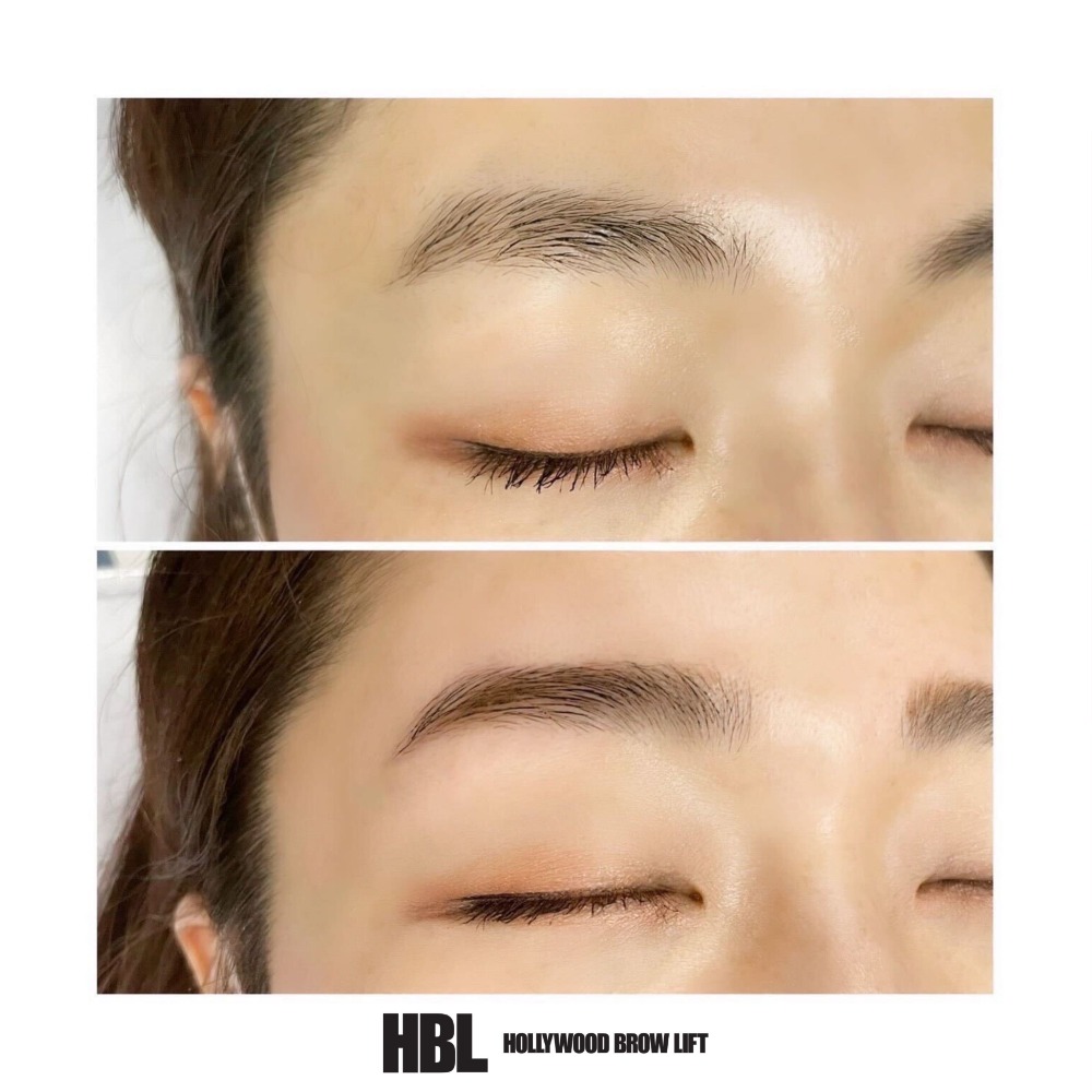 HOLLYWOOD BROW LIFT